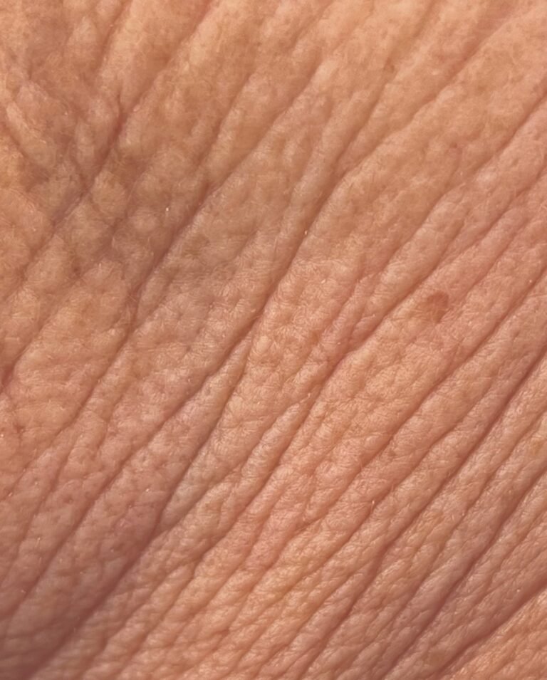 545314673_17868238908442226_7775460569829886188_n